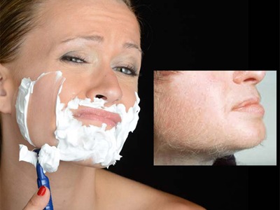 Vad är hirsutism?